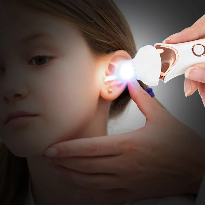 5-in-1 Electric Ear Wax Removal Tool