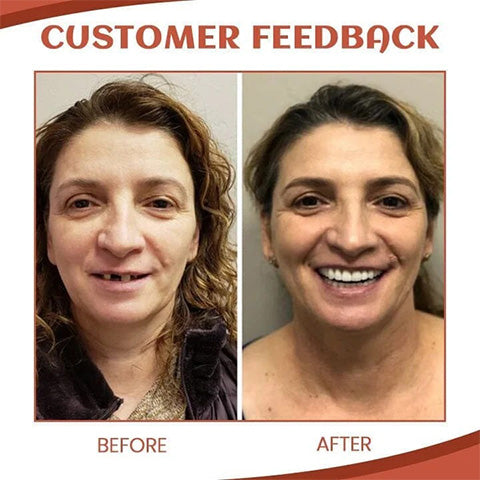 Experience Comfortable, All-Day Security with Pain-Free Dentures