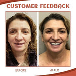Experience Comfortable, All-Day Security with Pain-Free Dentures