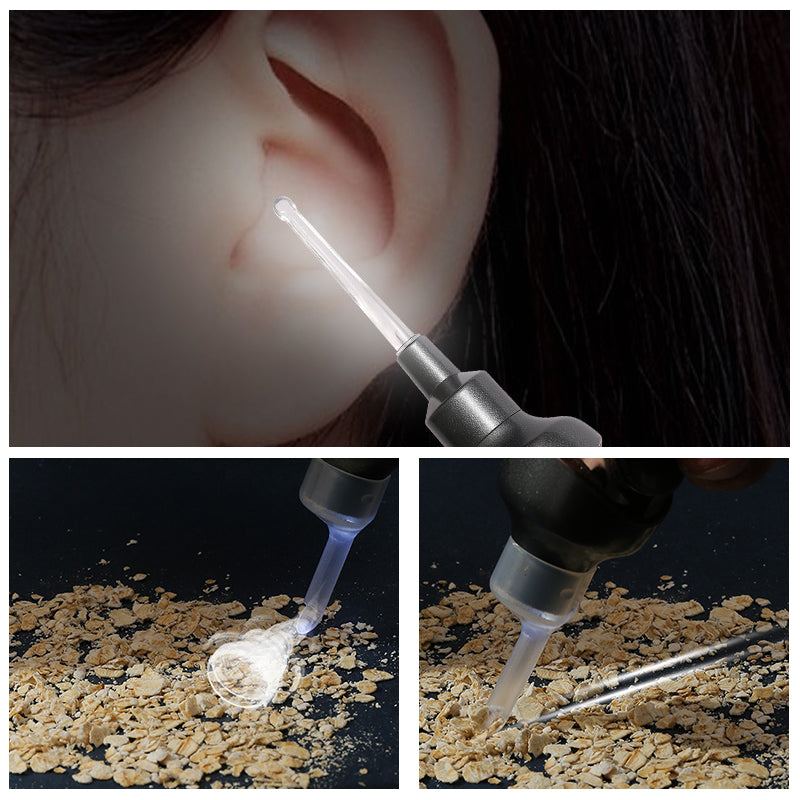 5-in-1 Electric Ear Wax Removal Tool