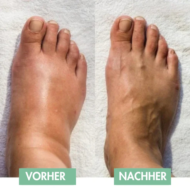 Innovative EMS Foot Massager for Instant Relief!
