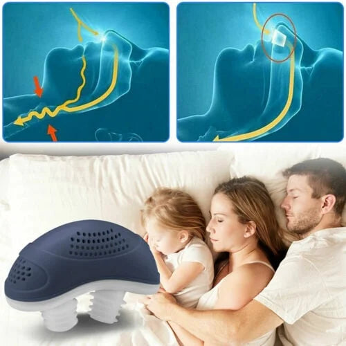 Silent, Compact Micro-CPAP Anti-Snoring Device