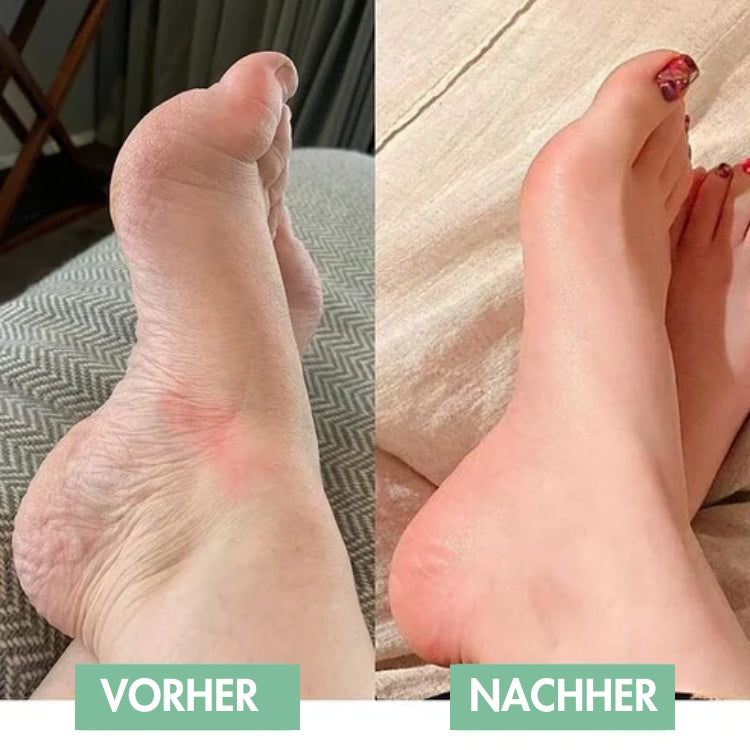 Innovative EMS Foot Massager for Instant Relief!
