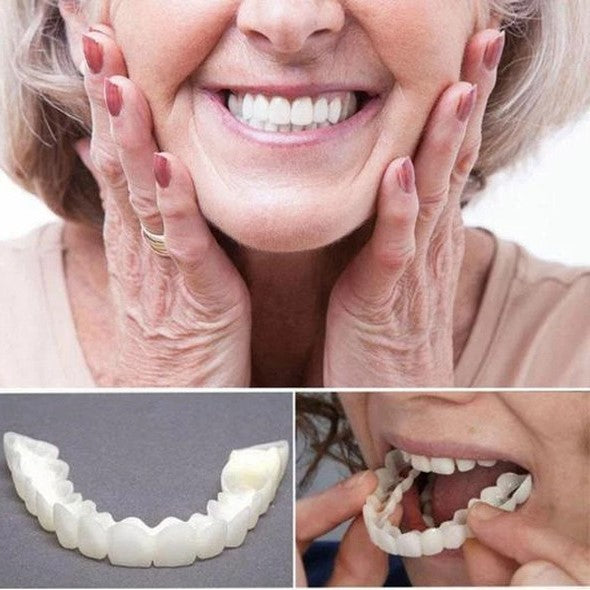On Smile Veneers for Upper and Lower Jaw