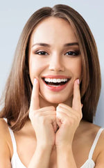 On Smile Veneers for Upper and Lower Jaw