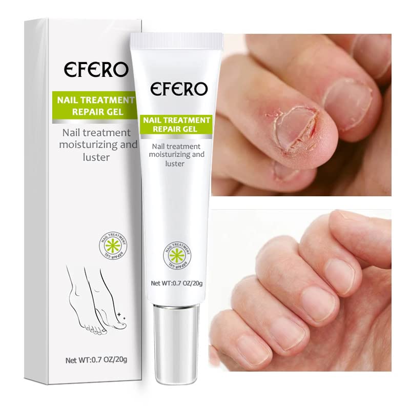 Buy One, Get One Free | Nail Repair Solution | Quick and Effective Results!