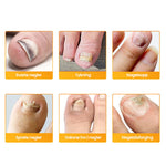 Buy One, Get One Free | Effective Treatment for Nail Fungus