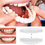 On Smile Veneers for Upper and Lower Jaw