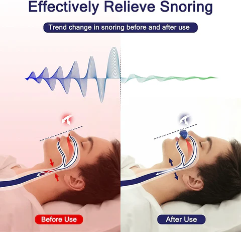 Compact Travel CPAP Machine for Sleep Apnea and Snoring Relief - Alternative Solution