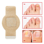Buy One, Get One Free | Effective Treatment for Nail Fungus