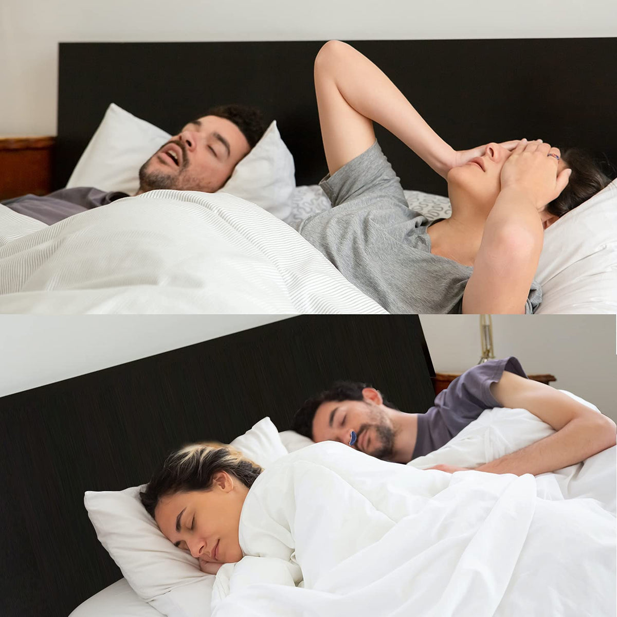 Wireless, Mask-Free Micro-CPAP Anti-Snoring Device