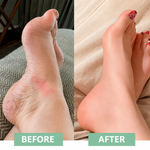Innovative EMS Foot Massager for Instant Relief!