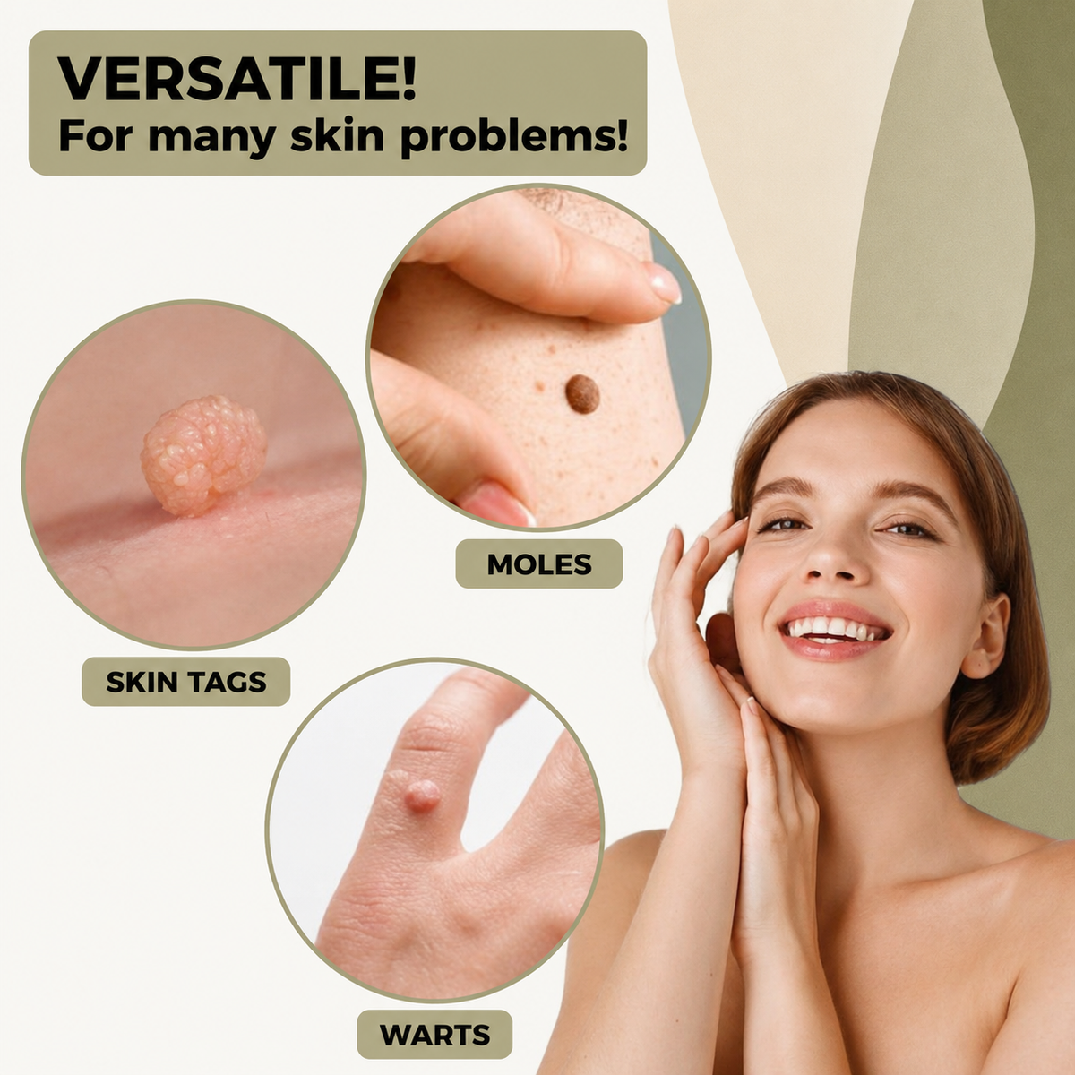 Wart Remover | Pain-Free Removal of Warts & Moles | For Home Use | No Surgery Required