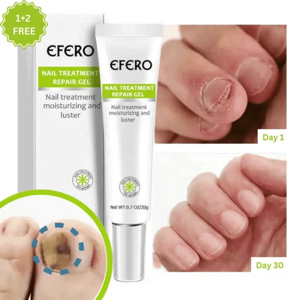 Nail Care Gel for Discolored and Brittle Nails | Intensive Treatment for Fingernails and Toenails | Promotes Healthier Looking Nails