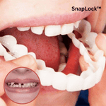 Buy One, Get One Free | Snap-In Denture