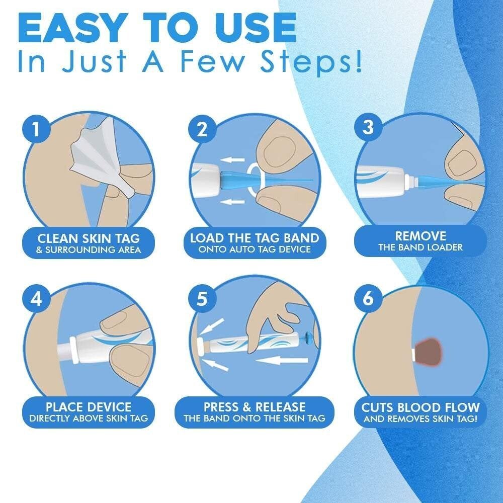 Auto-Tag Removal Kit | Pain-Free Application | Achieve Smooth & Even Skin