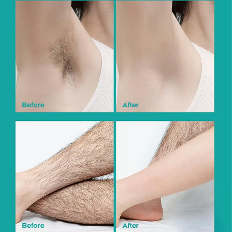 Gentle Hair Removal Cream | Buy 1 Get 1 FREE