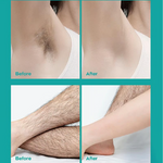 Gentle Hair Removal Cream | Buy 1 Get 1 FREE