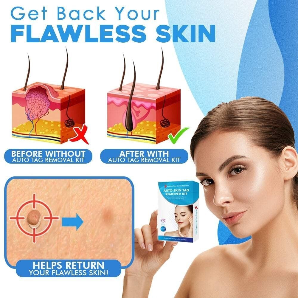 Auto-Tag Removal Kit | Pain-Free Application | Achieve Smooth & Even Skin