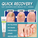 Buy One, Get One Free | Nail Repair Solution | Quick and Effective Results!