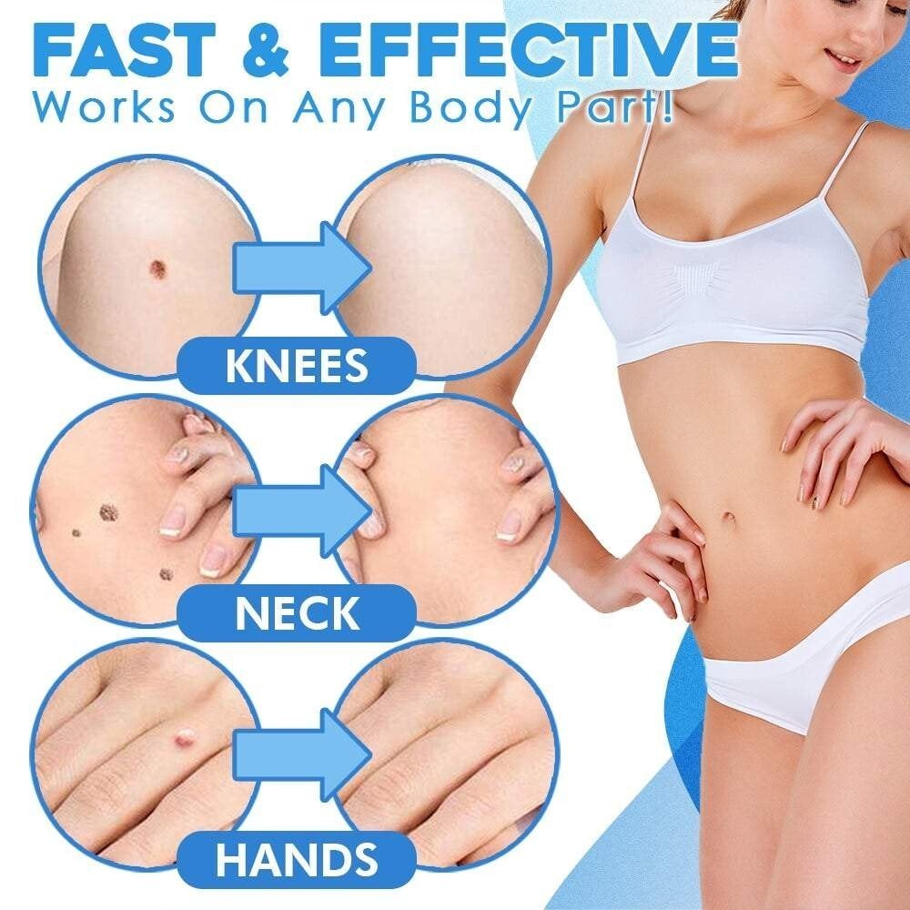Auto-Tag Removal Kit | Pain-Free Application | Achieve Smooth & Even Skin