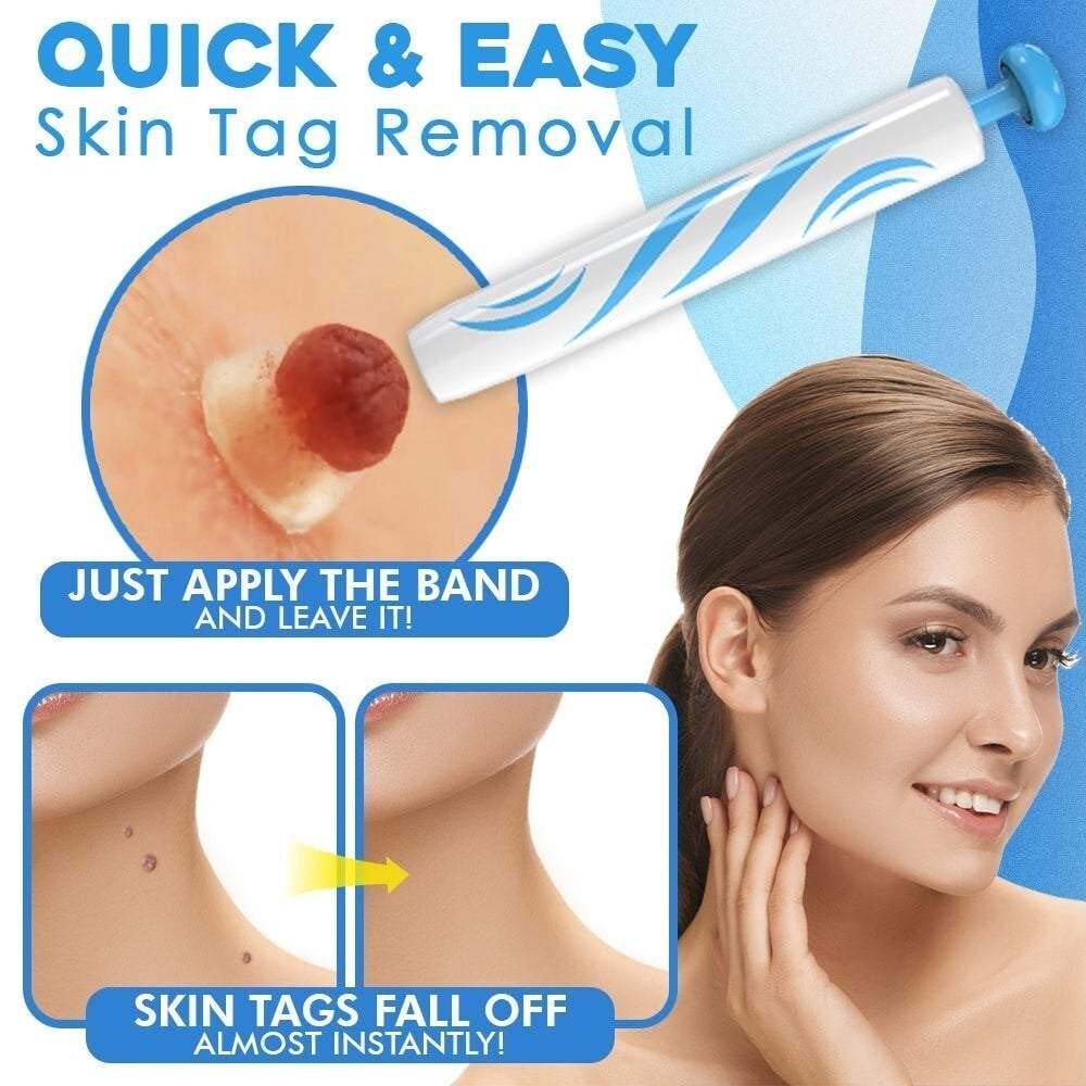Auto-Tag Removal Kit | Pain-Free Application | Achieve Smooth & Even Skin