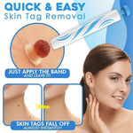 Auto-Tag Removal Kit | Pain-Free Application | Achieve Smooth & Even Skin