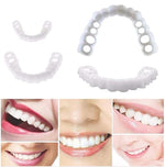 Buy One, Get One Free | Snap-In Denture